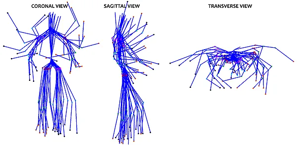 Stick-figure skeleton models fitted to statues, shown in coronal, sagittal and transverse views.